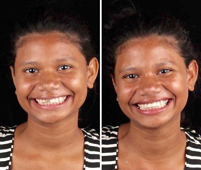 woman smiling after dentist treatment