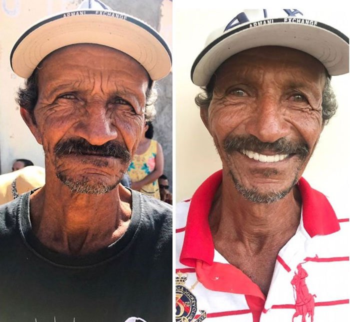 Man smiling after dentist treatment